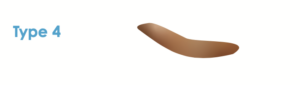 Type 4 - Bristol Stool Form Scale