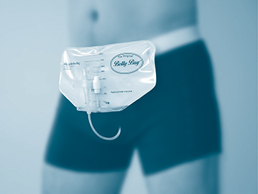 male with catheter bag