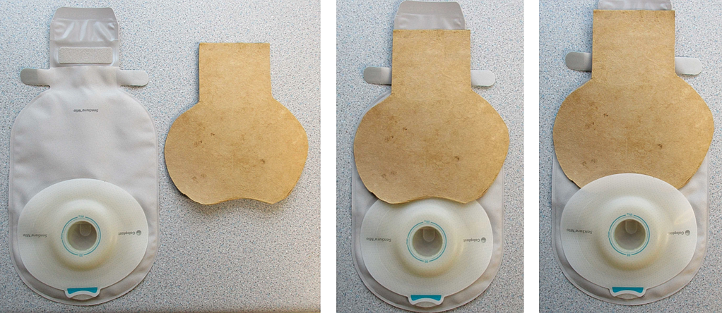 Stoma Bag - use of backing board to ease emptying